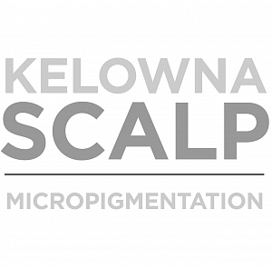 Kelowna Scalp Micropigmentation