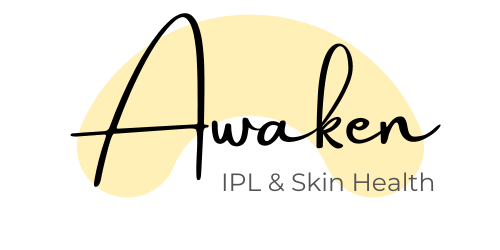Awaken IPL & Skin Health